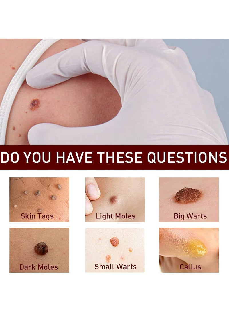 DubaiGallery Wipeoff Skin Tags & Moles Warts Corn Remover, Tags & Moles Remover,Wipeoff Tags & Moles Remover,Wipe Off Skin Tags and Mole Remover,Restore Skin Health and Beauty - Image 4