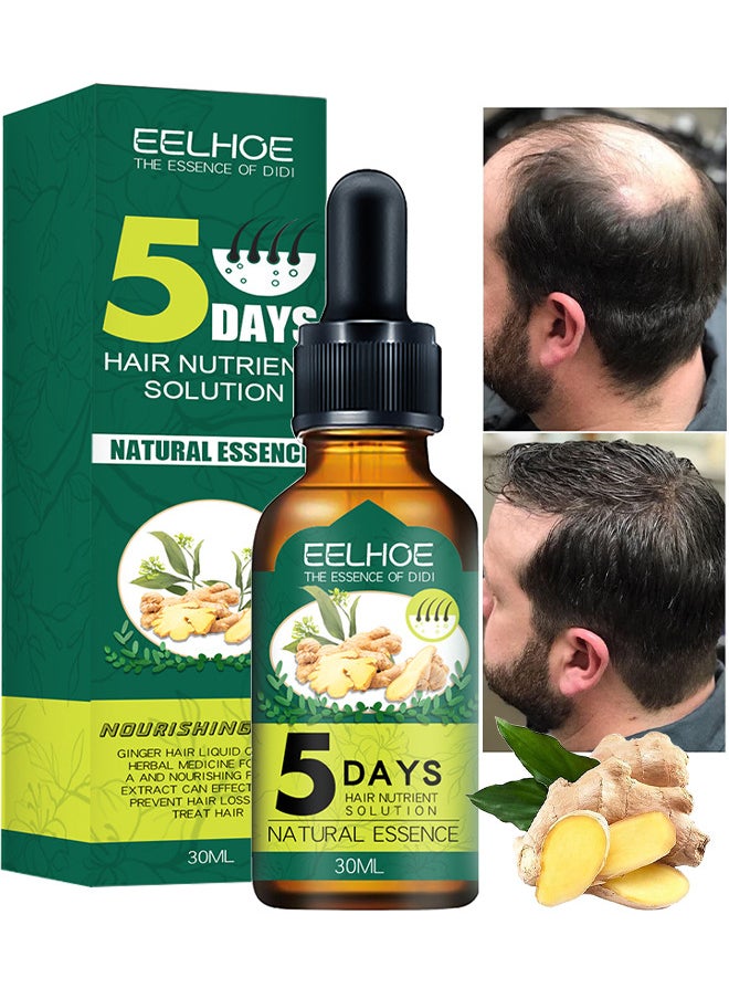 EELHOE - Hair Growth Essence For Hair Fall Hair Regrowth And Scalp, Treatment Ginger Essential Oil Supports Healthy Hair Thinning Treatment Hair Growth Oil For Men 30ML - Image 1