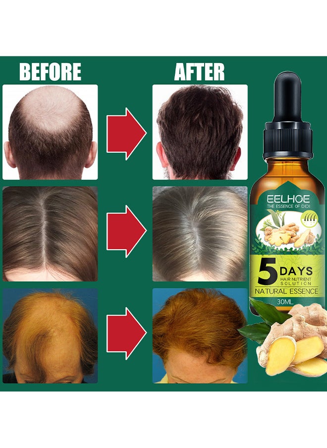 EELHOE - Hair Growth Essence For Hair Fall Hair Regrowth And Scalp, Treatment Ginger Essential Oil Supports Healthy Hair Thinning Treatment Hair Growth Oil For Men 30ML - Image 1