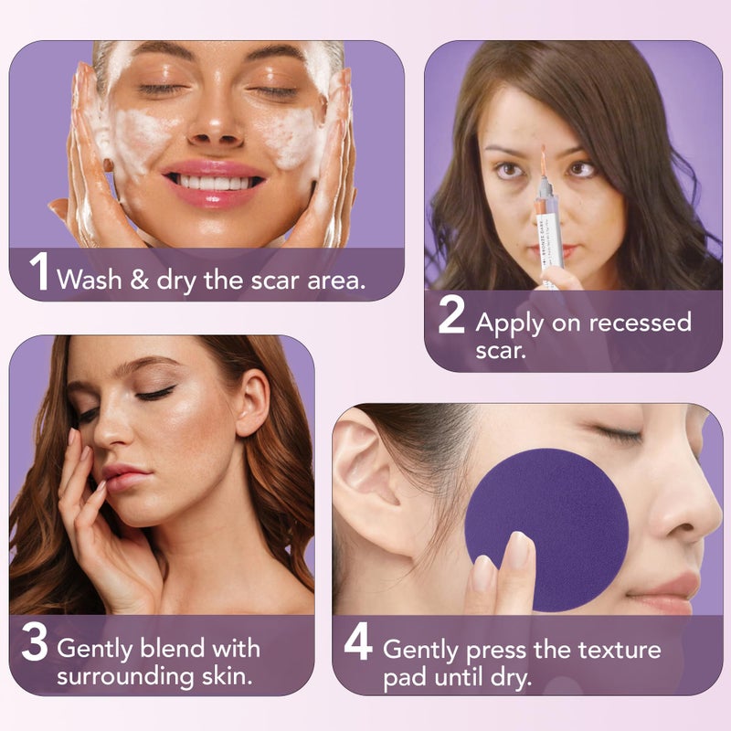 dermaflage مجموعة ملء الندبات ديرمافلاج - برونز داكن - تغطية عميقة للندبات وكريم أساس مقاوم للماء لندبات حب الشباب والتجاعيد وندبات الثلج، إمداد لمدة 1 شهر - Image 4
