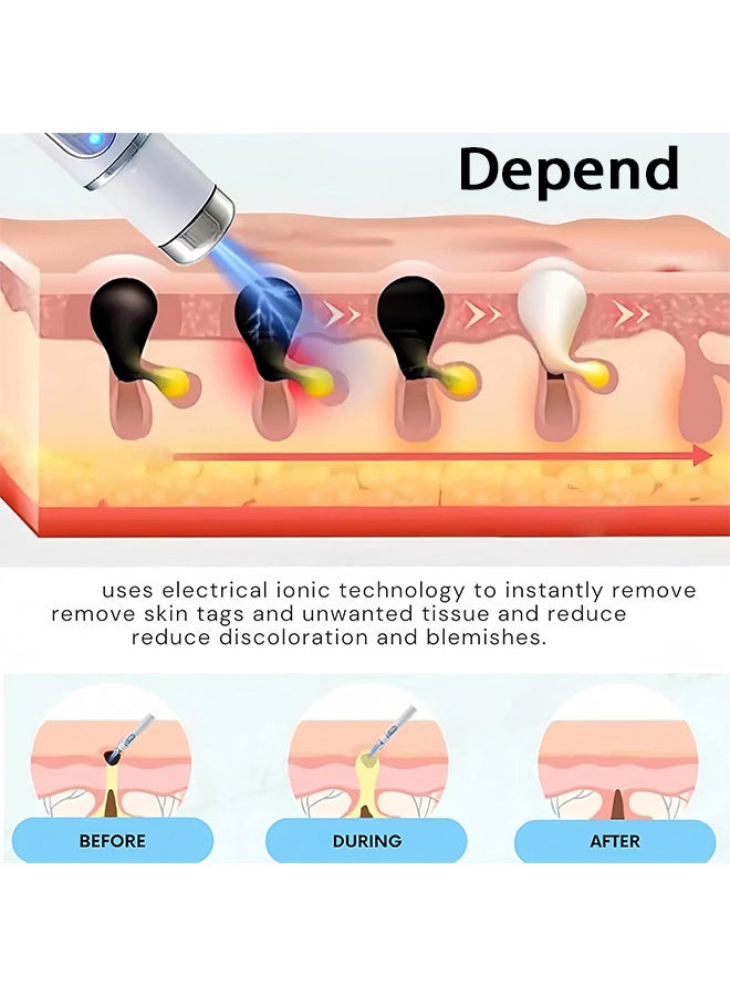 Depend Mole And Wart Removal Pen, Non-Invasive Mole And Wart Removal, 2025 Upgrade New Skin Tag Removal Pen, Smoothes And Reduces Blemishes, Dark Spot Corrector Stick, Portable Design, Suitable For All Types - Image 5