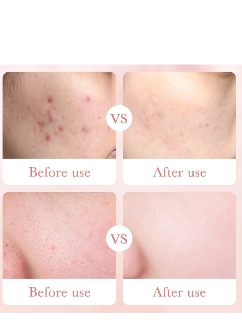 BIOAOUA Rose Water Toner with 98% Rose & Hyaluronic Acid, Vegan Hydrating and Nourishing Toner for Women – Korean Skincare Pore Minimizer & Exfoliating Toner for Rejuvenating and Soothing Skin 100ml - Image 5