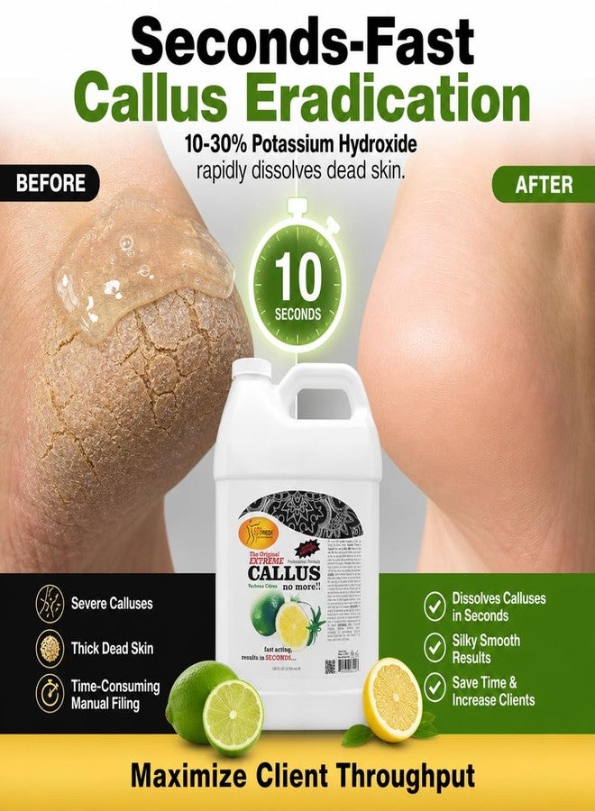 SPA REDI Professional Callus Remover, High-Performance Pedicure Treatment for Salons & Spas - Professional Strength, Unlimited Supply for Superior Callus Removal, Lemon & Lime, 128 Oz - Image 2