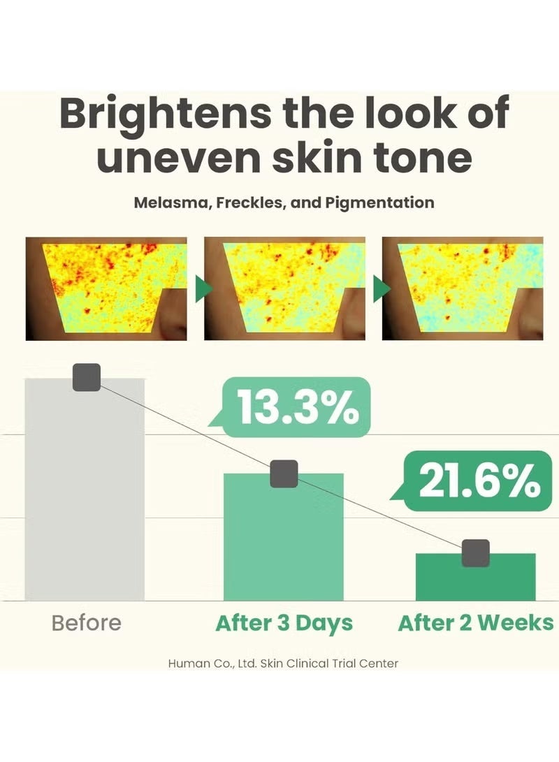 AXIS-Y Dark Spot Correcting Glow Serum 50ml / 1.69 fl. oz Brightening Serum Korean Skincare, Dark Spot Treatment, Hyperpigmentation Treatment - Image 4