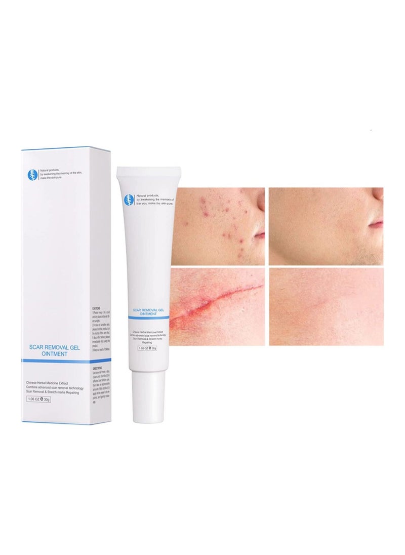 Scar Removal Gel Scar Repair Cream 30ml Herbal Repair Cream Fade Scars and Acne Marks Skin Care Repair Gel, Improve Dry Skin, Replenish Moisture and Nutrients Needed Deeply Moisturise - pzsku/ZB80392653FE8712E1789Z/45/_/1680620072/dac0248d-1809-47fa-ba00-9a6c5c012fb9