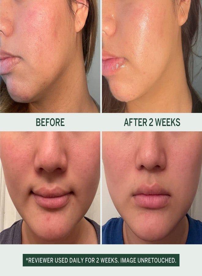 فايستوري تونر فيستوري أوربان كالم سوفت إيسنس للوجه، مرطب ومهدئ للبشرة، تونر للوجه مناسب للبشرة الحساسة والدهنية والجافة والمتقدمة في السن، 30 مل - Image 2