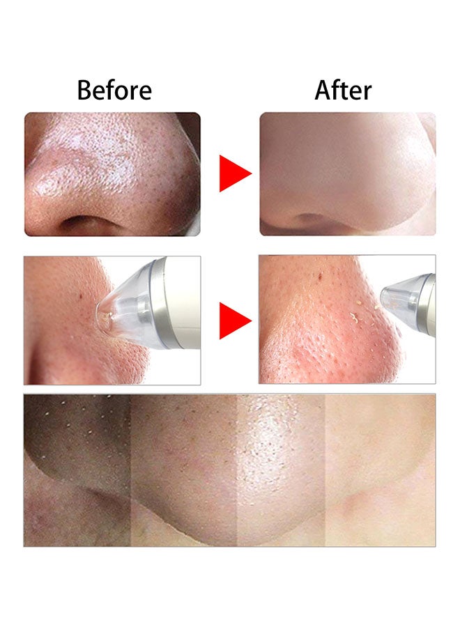 إسكدنيا آلة تنظيف مسام الوجه الكهربائية لإزالة الرؤوس السوداء 151x40.5x34.5مم - Image 3