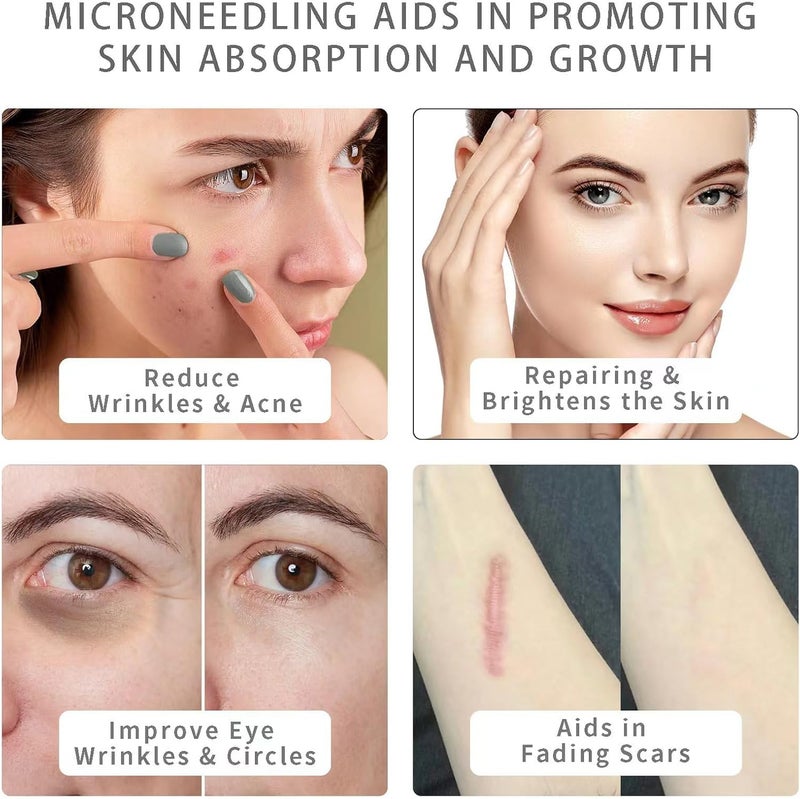 أداة ديرما على شكل ختم قابلة للتعديل مكونة من 140 إبرة تيتانيوم، بديل ديرما رولر، قلم ميكرونيدل قابل لإعادة الاستخدام مع غطاء إبرة، أدوات العناية بالبشرة للوجه والجسم وشعر اللحية - Image 3