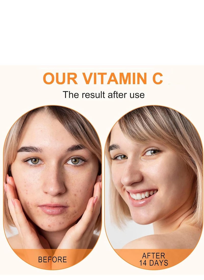 LANBENA - Vitamin C Serum for Face, With Hyaluronic Acid and Glycerol, Boosts Skin Collagen, Anti-Aging Wrinkle Treatment, Dark Spot Remover, Facial Skin Care Serum 15ml - Image 1