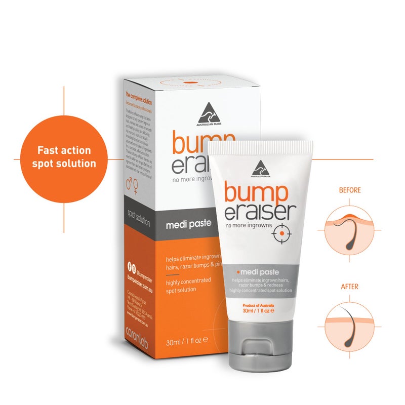 Bump Eraiser Medi Paste 1.0 fl oz for Shaving Rash, Ingrown Hair Treatment, Razor Bumps and Razor Burns - Image 5