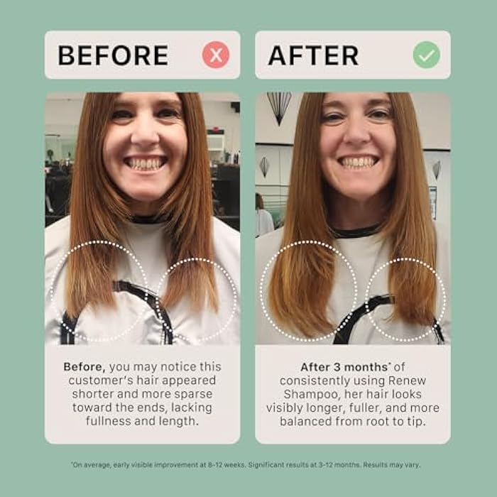 ACTIIV Renew Healing Shampoo Treatment | Improved Hair's Appearance, Promotes Scalp Health, Heals Damaged & Over-Processed Hair, Plant-Based, Color-Safe, Vegan, All Hair Types - Image 5