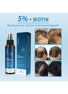 CARVENCHY Minoxidil Hair Regrowth Treatment,Hair Growth Serum 5% Minoxidil for Men and Women,Hair Regrowth Treatment for Stronger Thicker Longer Hair - With Biotin - Help to Stop Thinning and Loss Hair 3.38fl.oz/100ml  - Image 3