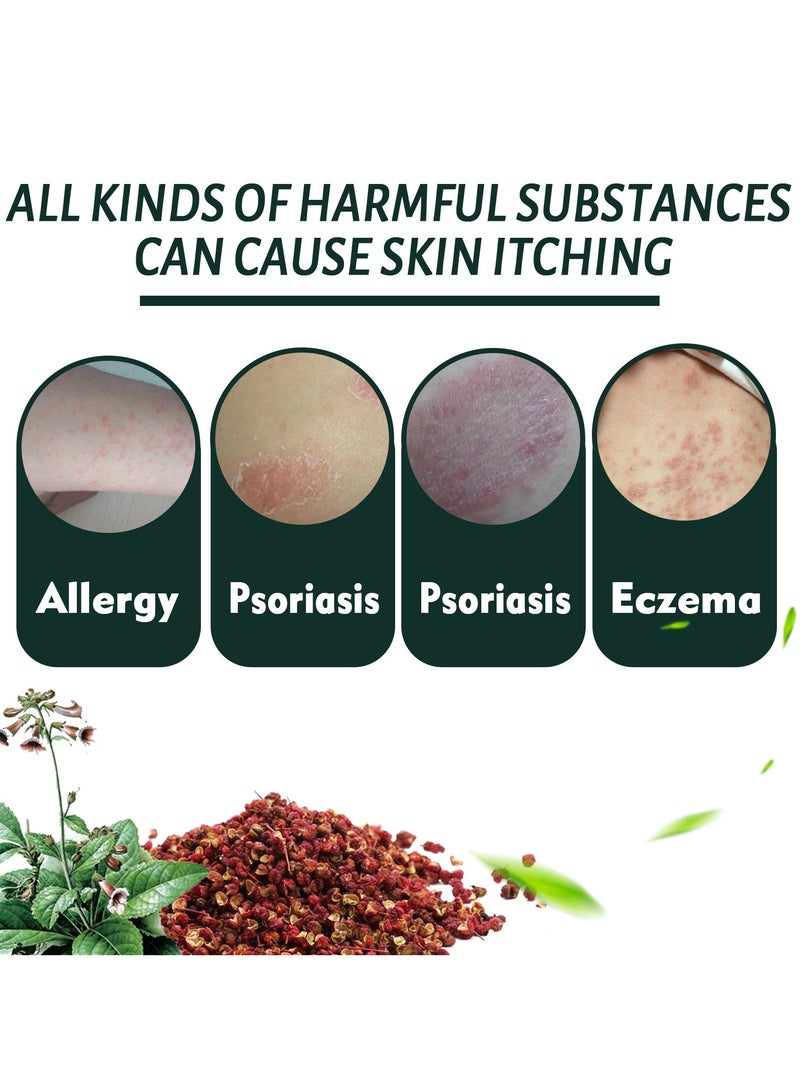 ساوث مون 3 عبوات من كريم إصلاح سعفة القدمين، لتخفيف حكة الجلد، وإصلاح وتخفيف الحكة 50 جرامًا*3 - Image 5