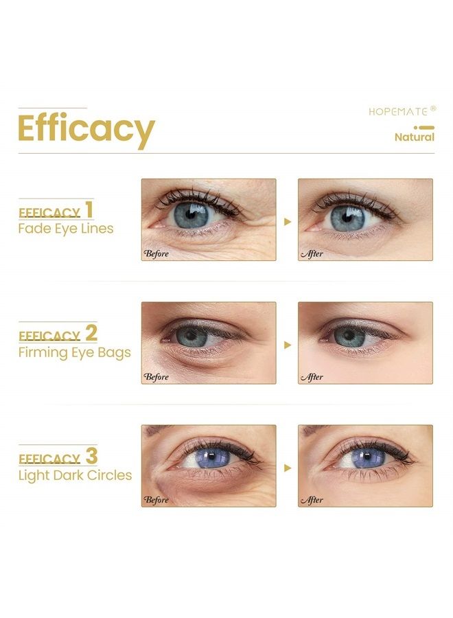 HOPEMATE Anti Age Eye Cream, Reduce Dark Circles, Puffiness Under Eye Bags,Effective Anti-Wrinkles Treatment, Anti-Aging Eye Gel with Hyaluronic Acid Natural and Organic Anti Aging Eye Balm To Reduce - Image 2