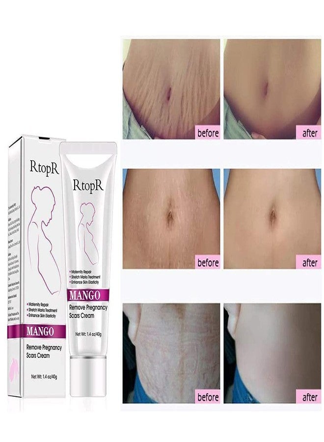 MQUPIN UniM Mango Stretch Marks and Scar Cream -Stretch Marks and Scar Removal Cream for Pregnancy - Best Body Moisturizer-40g - Image 2