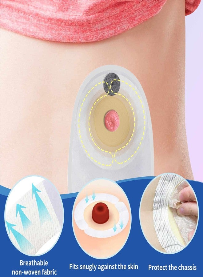 ovand شرائط حاجز الفغرة، مستلزمات الفغرة، شريط حاجز مرن للجلد، موسعات شريط حاجز الفغرة لأكياس فغر القولون اللاصقة بالجلد (20 قطعة) - Image 5