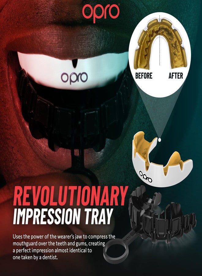 أوبرو واقي فم تقويم الأسنان OPRO Instant Custom-Fit، واقي فم طبيب الأسنان يتميز بقفص تركيب ثوري، راحة وحماية وملاءمة فائقة، واقي لثة تقويم الأسنان للرجبي والملاكمة والفنون القتالية المختلطة والهوكي (أسود) - Image 4