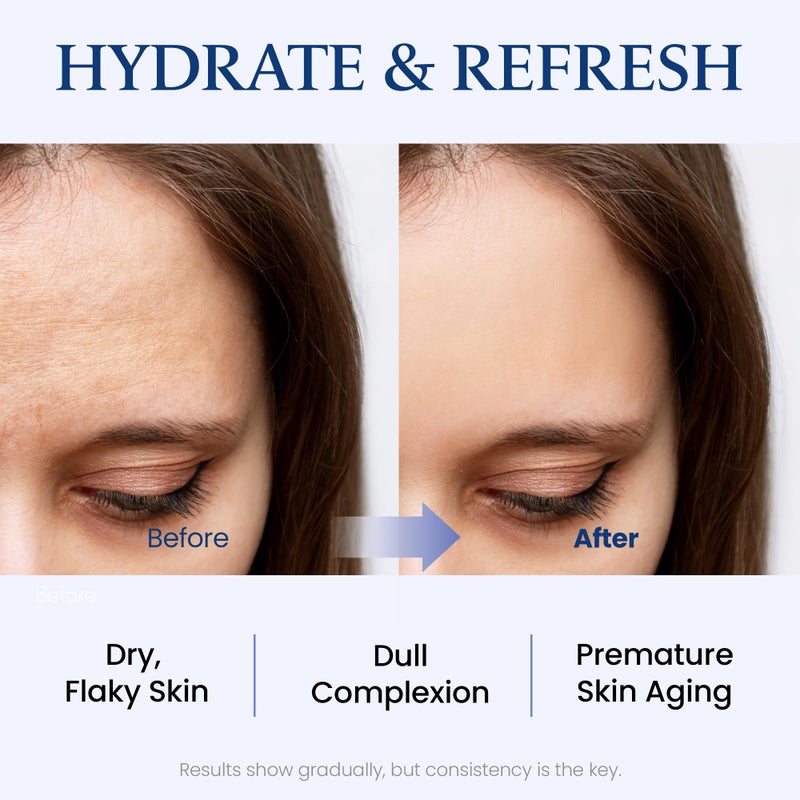 MAXCLINIC Water Lift Moisture Ampoule for Dry Skin | Deeply Hydrating Serum for Face | Fortifying Facial Serum & Ampoule Korean Skin Care | Highly Moisturizing Face Serum (3.38 fl oz) - Image 4