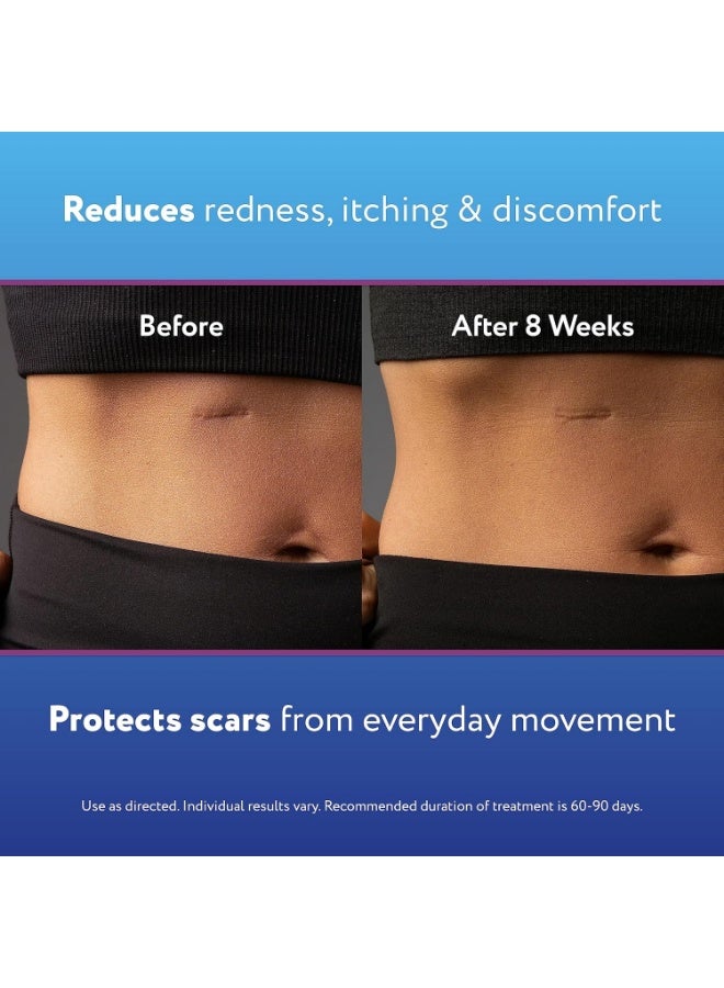 Scaraway scar diminishing gel, 20 gram - Image 4