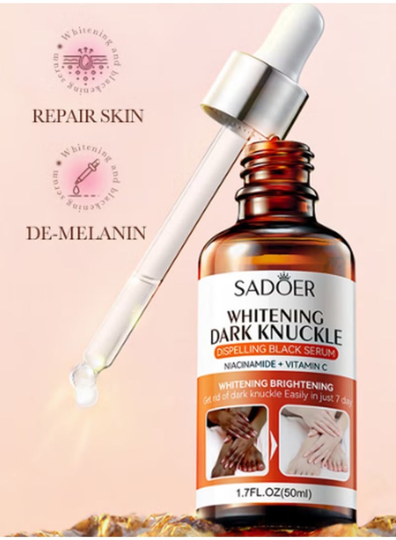 SADOER Whitening Dark Knuckle Dispelling Black Serum with Niacinamide + Vitamin C, Skin Brightening Cream, Dark Spot Remover Cream for Feet & Elbow & Neck & Hands, Get Rid of Dark Knuckle Easily in 7 Days - Image 1