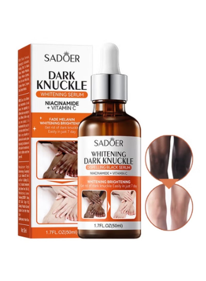 SADOER Whitening Dark Knuckle Dispelling Black Serum with Niacinamide + Vitamin C, Skin Brightening Cream, Dark Spot Remover Cream for Feet & Elbow & Neck & Hands, Get Rid of Dark Knuckle Easily in 7 Days - Image 2