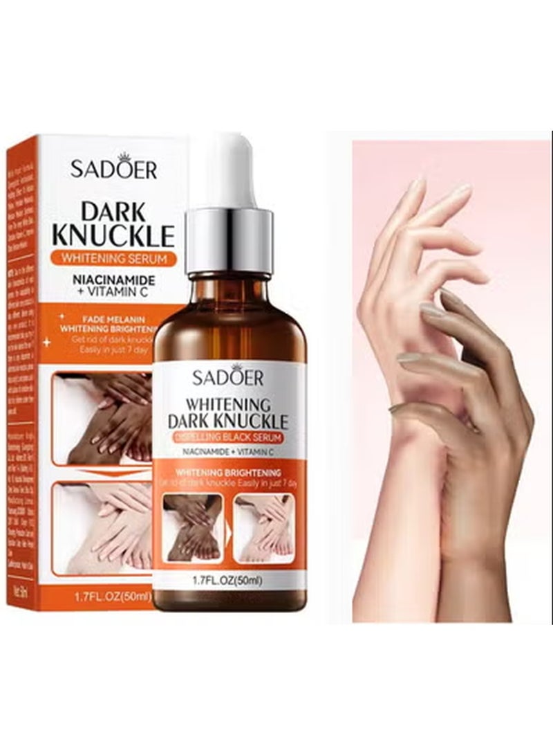 SADOER Whitening Dark Knuckle Dispelling Black Serum with Niacinamide + Vitamin C, Skin Brightening Cream, Dark Spot Remover Cream for Feet & Elbow & Neck & Hands, Get Rid of Dark Knuckle Easily in 7 Days - Image 3