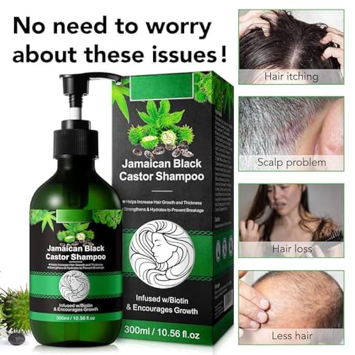 RTBYUE Jamaican Pure Cold Pressed Black Castor Oil Shampoo and Growth Set - 10.56 fl.oz Strengthen and Restore Shampoo for Damaged Hair - Image 4