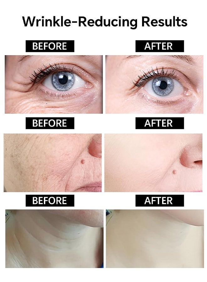 OUHOE Botox Bee Venom Cream Wrinkle Removal & Firming, Moisturizing, Lifting & Recovery For All Skin Type, Anti-Aging Bee Venom Cream, Lifting & Recovery, Face Cream Moisturiser, Recovery and Anti-Wrinkle Care Cream, 20g - Image 2