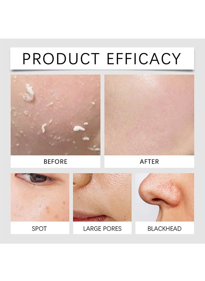 Hoygi - Bha Blackhead Power Liquid，Liquid Salicylic Acid Exfoliant, Salicylic Acid Toner for Face, Moisturizing Toner with Salicylic Acid for Exfoliation 100ml - Image 1