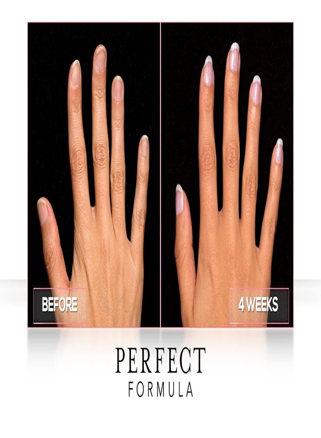 Perfect Formula Daily Moisture Treatment, 0.5 Fl Oz - Image 5