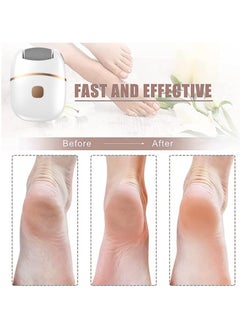 Adando Adando Electric callus remover Removable grinding head Rechargeable electronic feet file Electric pedicure kit Foot rubbing Dead skin remover For all people  - Image 3