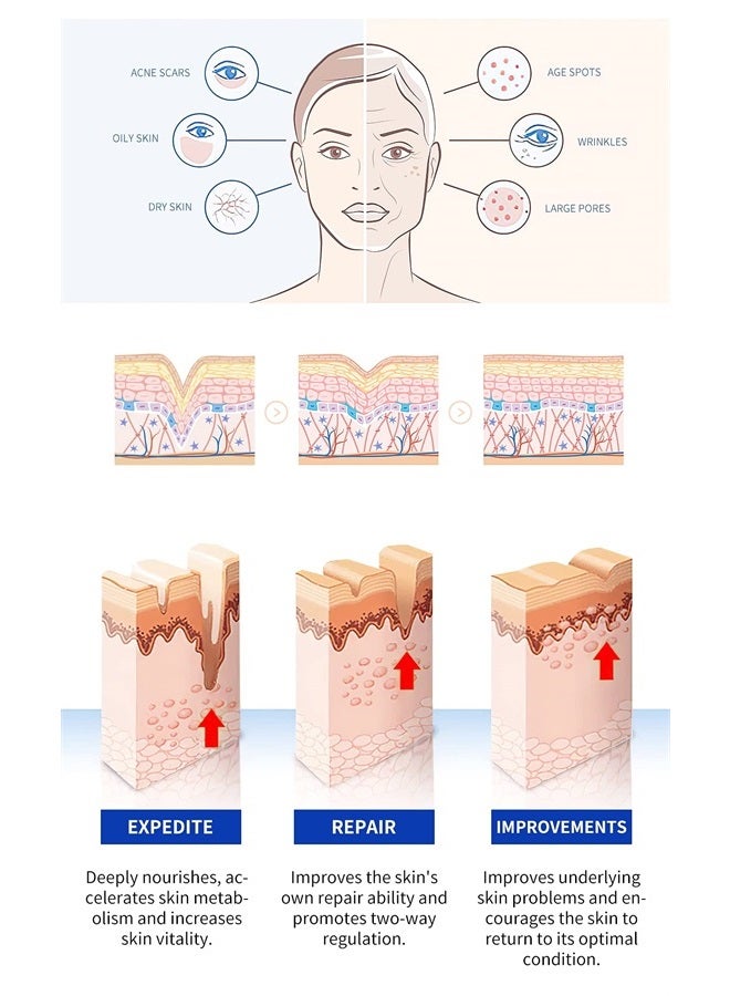 PUICMLNA قلم المايكرونيدلنج Puicmlna مع 30 قطعة إبرة وخرطوشات نانو بحجم 0.1 مم، 9 × 42 إبرة، 9 × 36 إبرة، 6 × 12 إبرة، 6 × سلسلة نانو مختلطة - خرطوشات قابلة للاستبدال بإبر قابلة للتخلص منها - Image 2