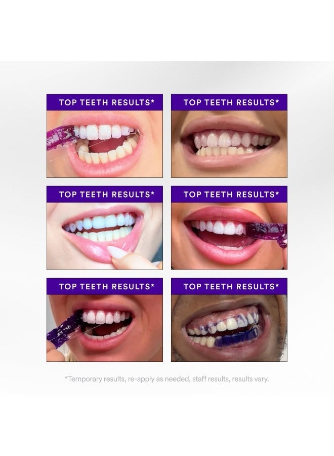 Hismile V34 Whitening Strips, Teeth Whitening Strips, Purple Tooth Whitening, Purple V34 Whitening Strips, Tooth Stain Treatment, Combining Whitening and Colour Correction - Image 5