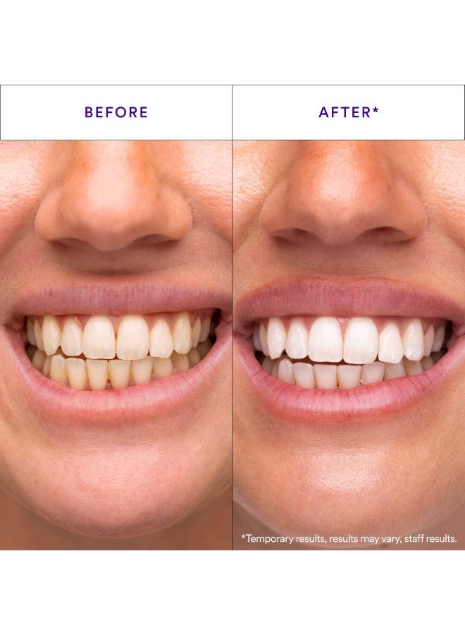 Hismile V34 Whitening Strips, Teeth Whitening Strips, Purple Tooth Whitening, Purple V34 Whitening Strips, Tooth Stain Treatment, Combining Whitening and Colour Correction - Image 4