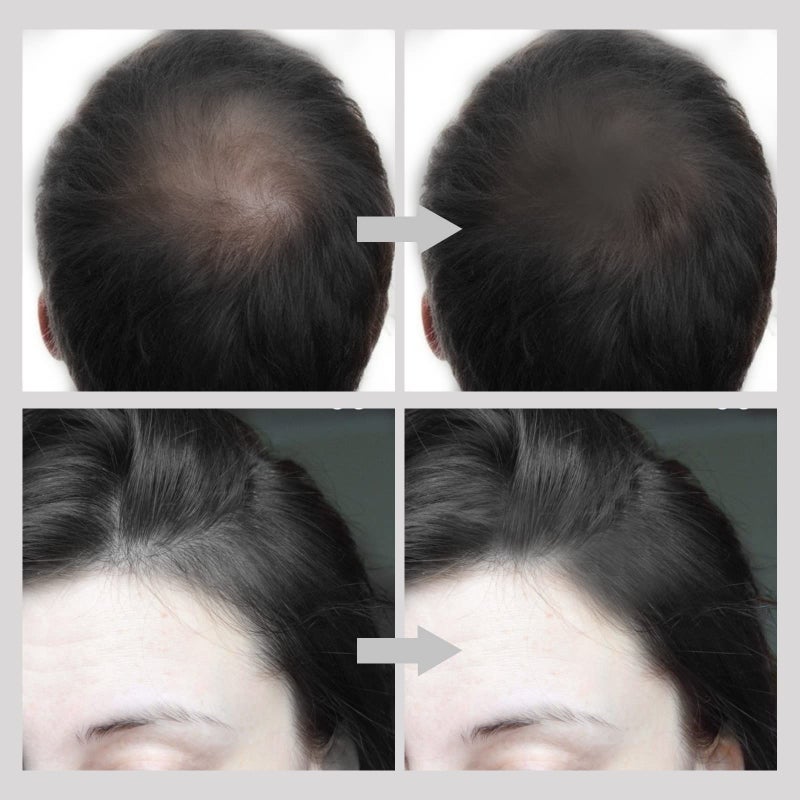 Boobeen Hairline Powder Stick, Root Touch Up for Thinning, Greys Hair, Instantly Cover Up, Multi Contour Concealer - Image 2