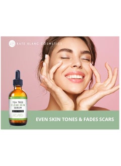 Tea Tree Serum for Face and Acne Prone Skin (1oz). Tea Tree Oil Face Serum to Fight Acne Scars, Pimples, Dark Spots. Promotes Clear Skin for Teens - pzsku/ZB8B6432E94A6E80994B6Z/45/_/1736784148/67fa23c9-8c1f-4a64-8664-6cab618645cc