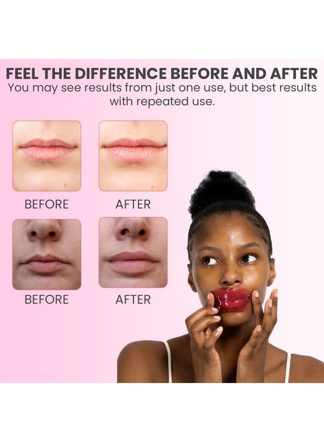 MISS SPA Lip Mask Hydrate + Boost Hydrogel Pink Lip Mask Sooth & Restore Lips Lip Plumper Moisturizing And Reducing Fine Lines Antiaging Nourishing Honey Lip Patches (4 Pieces) - Image 4