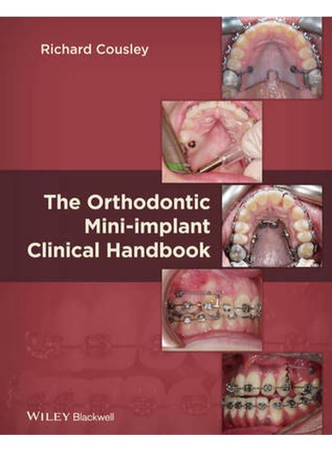 The Orthodontic Mini-implant Clinical Handbook Ed 1 