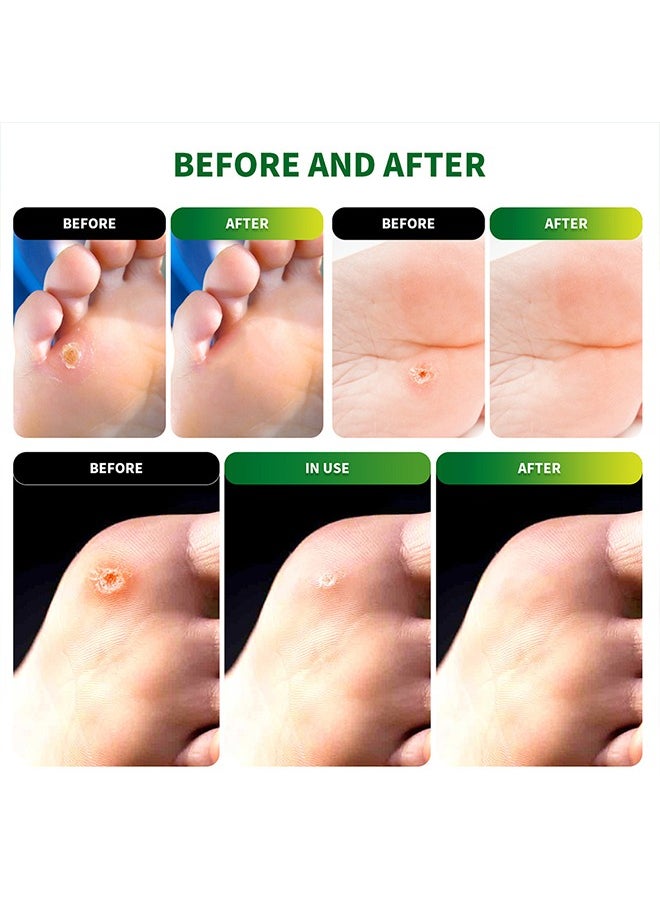 Sumifun 54 Pcs Foot Corn Removal Plaster,Natural Ingredients,Foot Care Expert,Calluses Plantar Treatment,Relief Pain From Calluses, Corns, Blisters, Heel Frictions  - Image 4