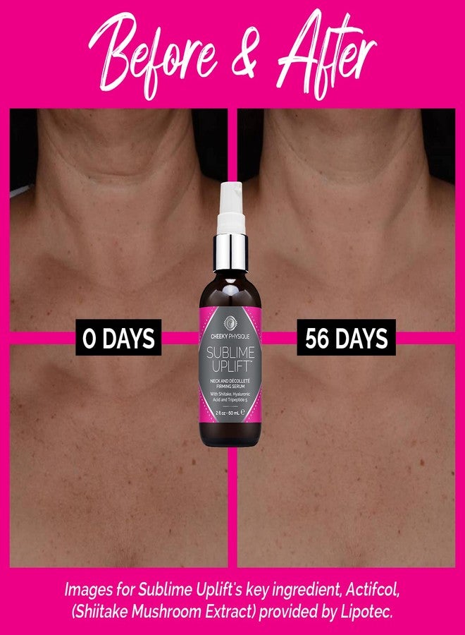 Cheeky Physique Sublime Uplift Neck Firming Serum - Tightening Cream for Crepey Skin & Wrinkles on the Neck, Chest & Decollete - Anti Aging Treatment Lotion with Shiitake Mushroom Extract, Hyaluronic Acid & Peptides - Image 4