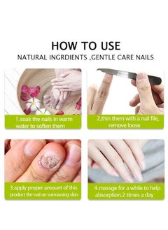 efero Nail Treatment and Repair Gel For Shiny and Healthy Nails Use For Women 20g  - Image 4