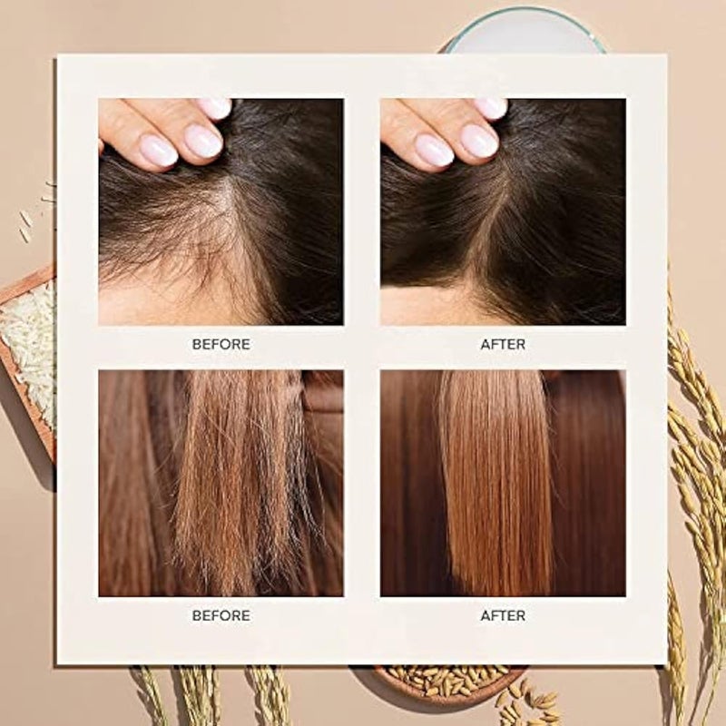 ProBliva Hair Serum: Rice Water, Rosemary Oil, Castor Oil for Thicker, Longer and Fuller Hair - Hair Products for Women and Men With Biotin and Caffeine - Image 3