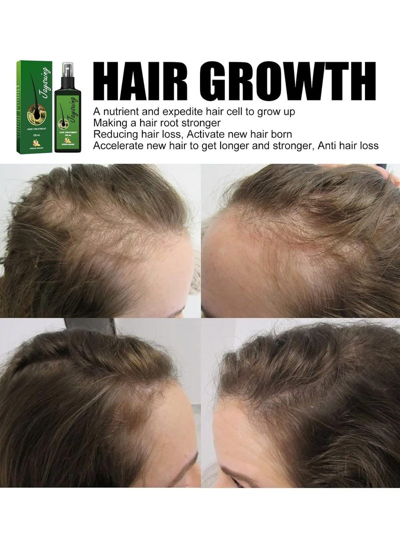 Jaysuing Growth Plus Nourishing Ginger Spray, Natural Nourishing Scalp Spray, Fast Hair Growth Intensive Anti-Shedding Treatment Ginger Spray, Ginger Spray to Promote Male and Female Hair Growth  - Image 4