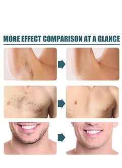ibcccndc Hair Removal Spray, Painless Hair Removal Spray Armpit Gentle Hair Remover Refreshing Quick Hair Removal Spray, Safe Hair Removal for Underarm, Chest, Back, Leg and Private Part  - Image 3