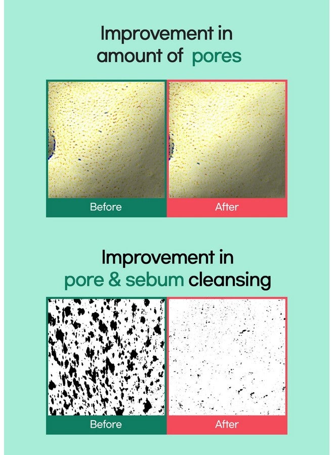 برينج جرين مجموعة طين شجرة الشاي السيكا للمسام، مجموعة مزدوجة، قناع طين نباتي لتنظيف المسام العميقة لتنقية المسام، يحتوي على السيكا وشجرة الشاي لتهدئة وتخفيف البشرة المجهدة - Image 4