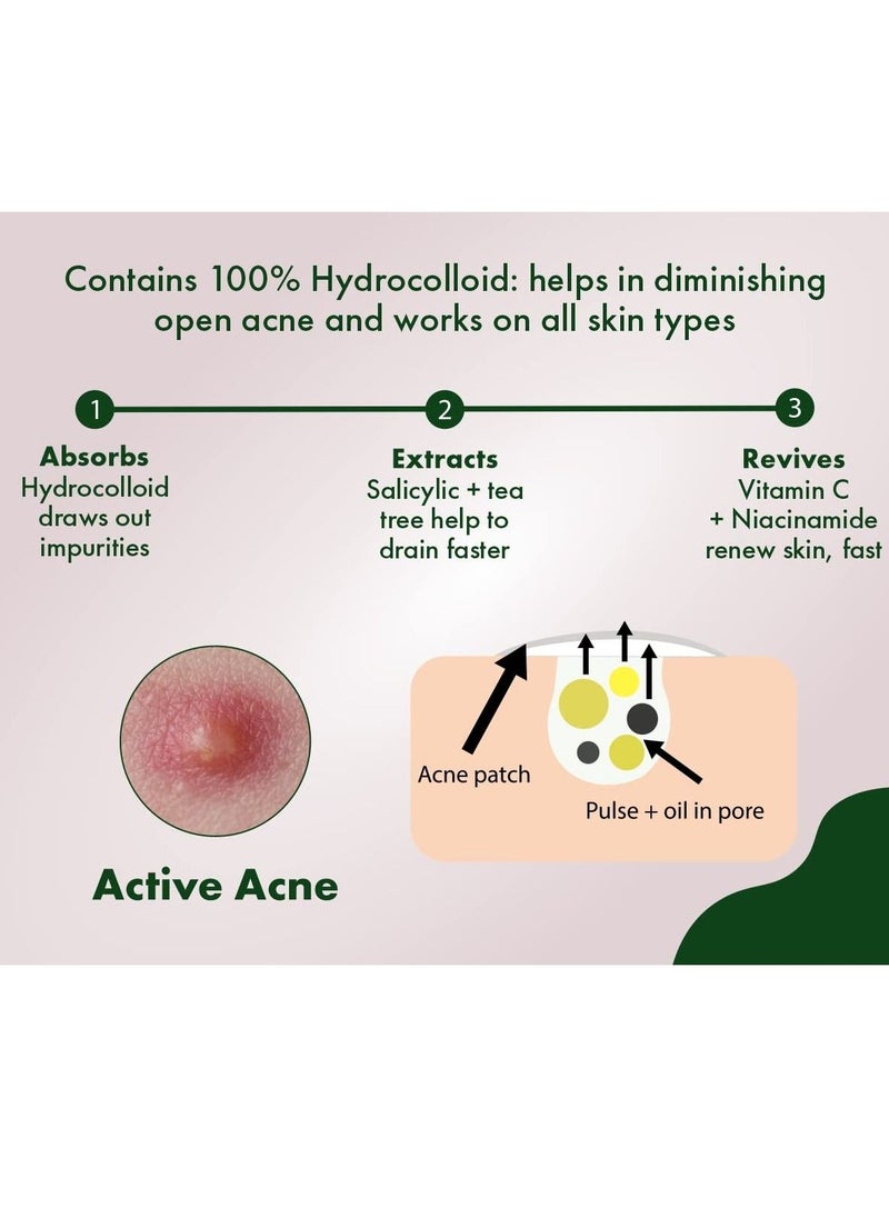Urban yog - Acne Pimple Patch Invisible Facial Stickers cover with 100% Hydrocolloid Pimple Patches for Face 72 Dots - Image 1