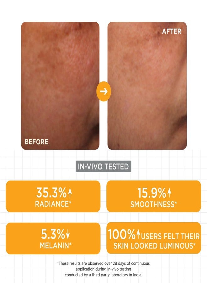 SKINQ Brightening Face Serum with Kojic Acid, Lactic Acid & Malic Acid | Skin Radiance | Reduces Tan, Pigmentation & Dark Spots | Lightweight Glow Serum | For All Skin Types | In-Vivo Tested | Dermatologist Formulated (Pack of 2) - Image 4