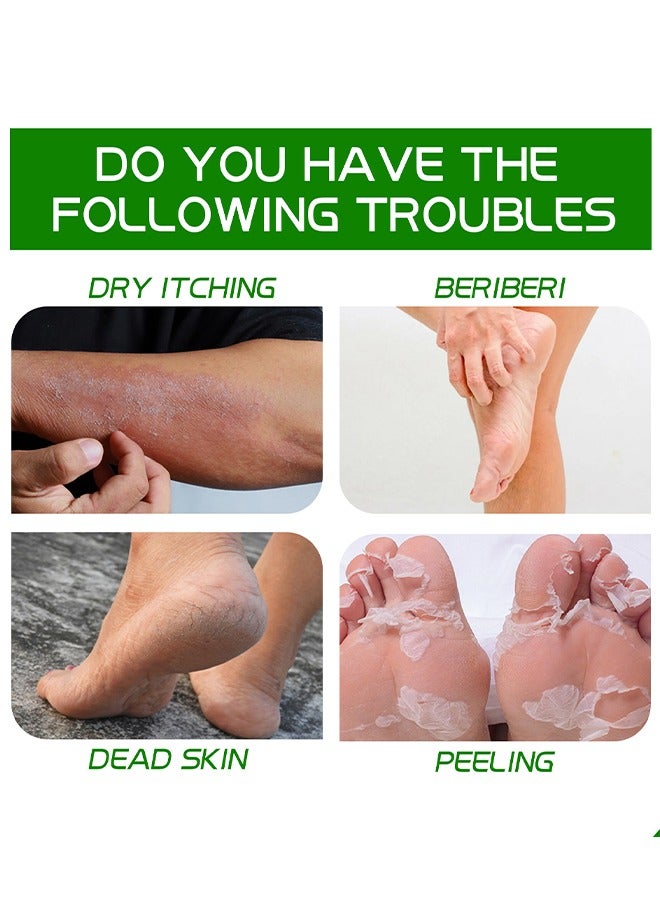 EELHOE Allantoin 40% Cream For Cracked,Rough Thick and Dry Skin Soothes and Softens Feet,Elbows and Knees Hydrating and Moisturizing Foot Care Cream 100g - Image 4