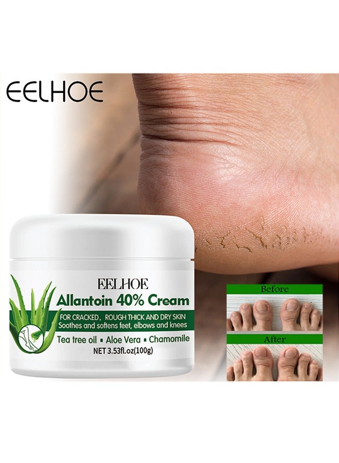 EELHOE Allantoin 40% Cream For Cracked,Rough Thick and Dry Skin Soothes and Softens Feet,Elbows and Knees Hydrating and Moisturizing Foot Care Cream 100g - Image 1