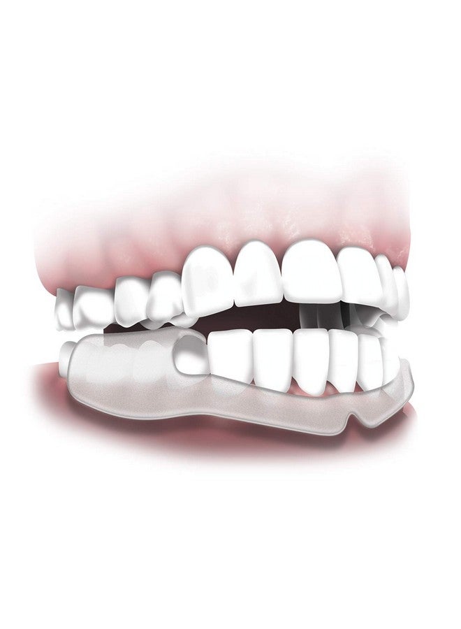 بلاكرز واقي الأسنان الليلي Grind No More لمنع صرير الأسنان، 14 قطعة - Image 5